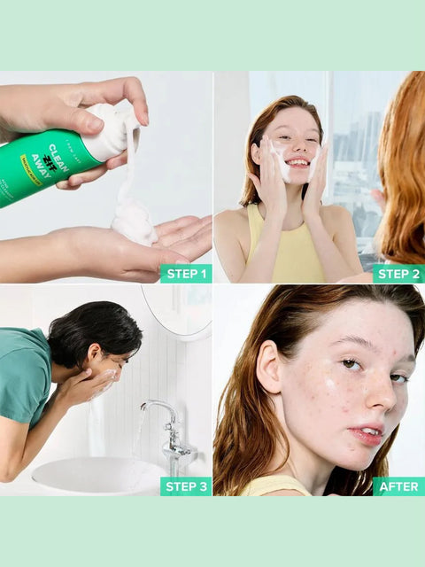 I DEW CARE CLEAN ZIT AWAY ACNE FOAMING CLEANSER